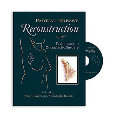 Partial Breast Reconstruction: Techniques in Oncoplastic Surgery