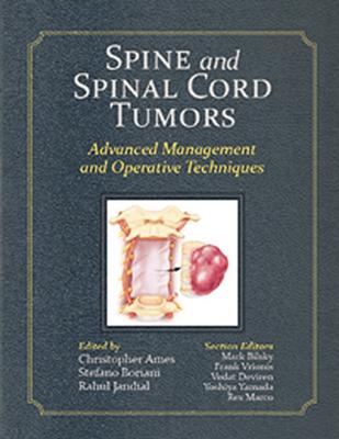 Spine and Spinal Cord Tumors