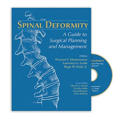 Spinal Deformity