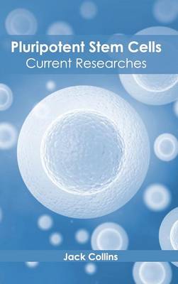 Pluripotent Stem Cells: Current Researches