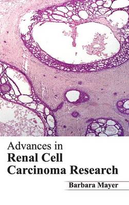 Advances in Renal Cell Carcinoma Research