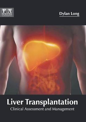 Liver Transplantation: Clinical Assessment and Management