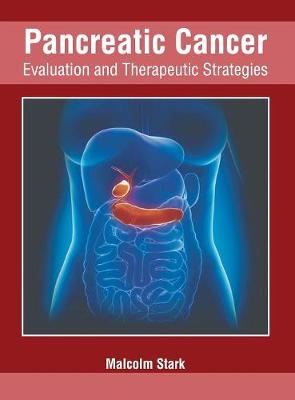 Pancreatic Cancer: Evaluation and Therapeutic Strategies