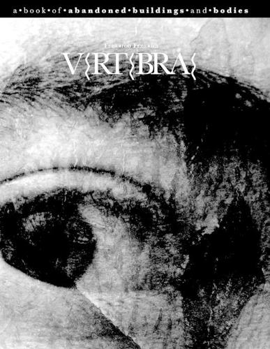 Vertebrae