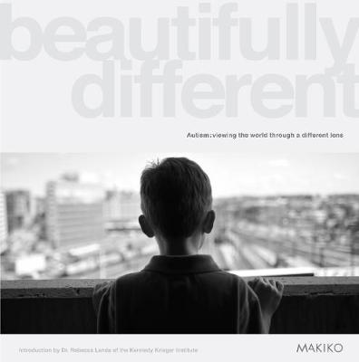 Beautifully Different