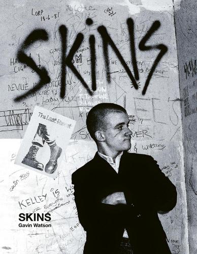 Skins - Special Edition