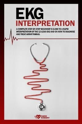 Ekg Interpretation