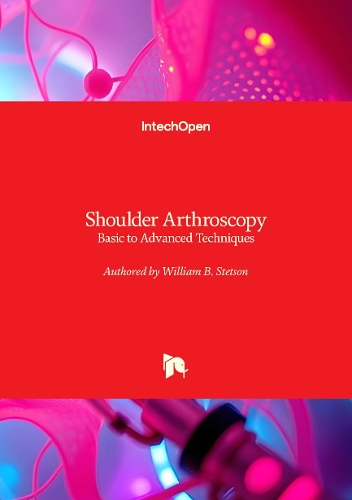 Shoulder Arthroscopy