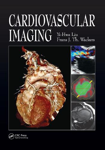 Cardiovascular Imaging