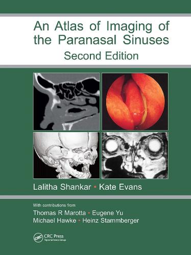 Atlas of Imaging of the Paranasal Sinuses, Second Edition