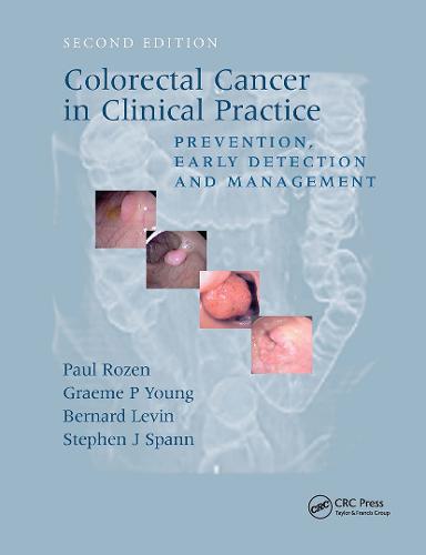 Colorectal Cancer in Clinical Practice