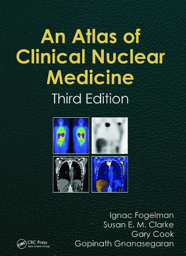 Atlas of Clinical Nuclear Medicine