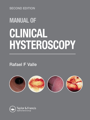 Manual of Clinical Hysteroscopy, Second Edition