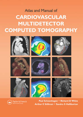 Atlas and Manual of Cardiovascular Multi-detector Computed Tomography