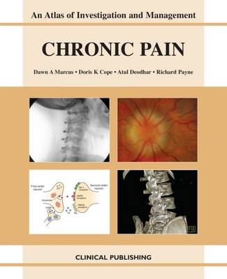 Chronic Pain