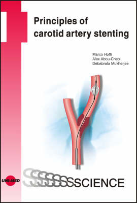 Principles of Carotid Artery Stenting