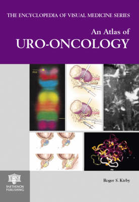 An Atlas of Uro-oncology