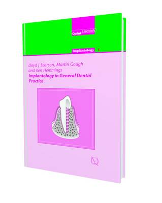 Implants for the General Dental Practitioner