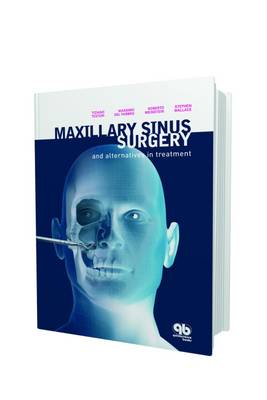 Maxillary Sinus Surgery and Alternatives in Treatment