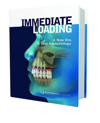 Immediate Loading