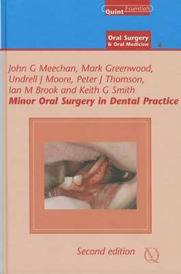 Minor Oral Surgery in Dental Practice
