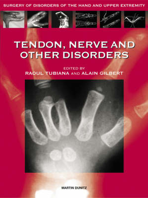 Nerve Tendon and Other Disorders