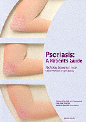 Psoriasis