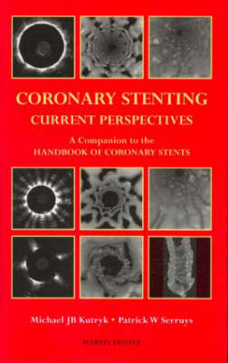 Coronary Stenting
