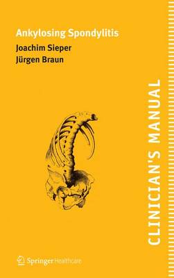 Clinician's Manual on Ankylosing Spondylitis