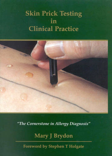 Skin Prick Testing in Clinical Practice