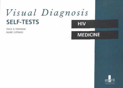 Visual Diagnosis Self-tests in HIV Medicine