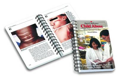 Child Abuse Quick Reference