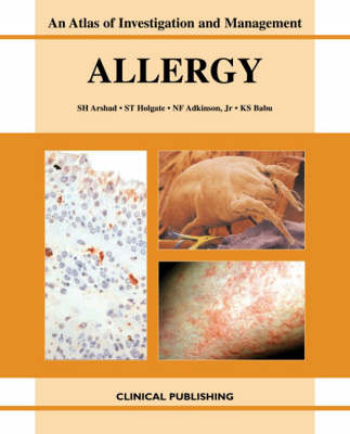 Allergy