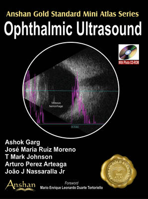 Mini Atlas of Ophthalmic Ultrasound