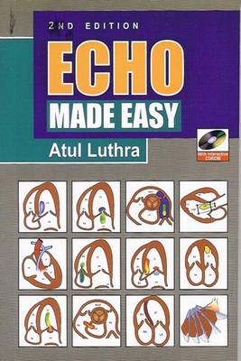 Echo Made Easy