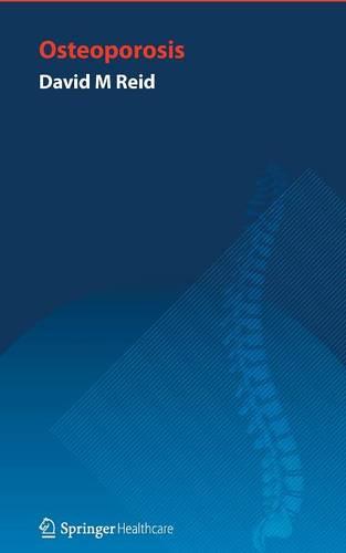 Handbook of Osteoporosis