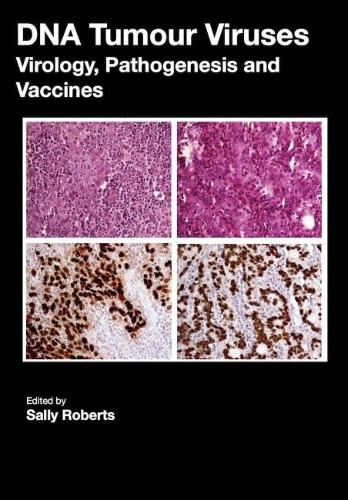 DNA Tumour Viruses