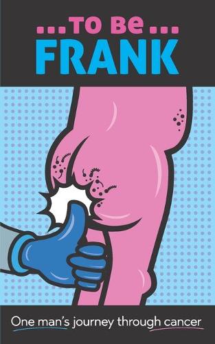 To Be Frank