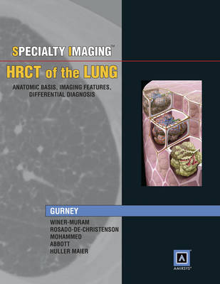 Specialty Imaging: HRCT of the Lung