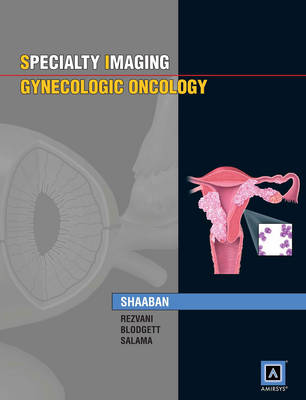 Specialty Imaging: Gynecologic Oncology