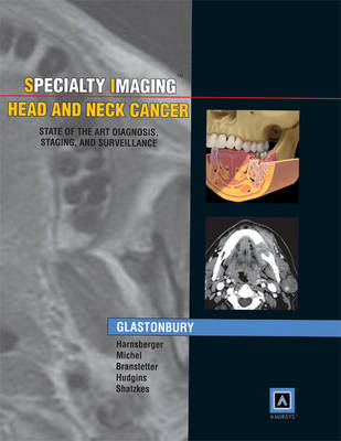 Specialty Imaging: Head & Neck Cancer