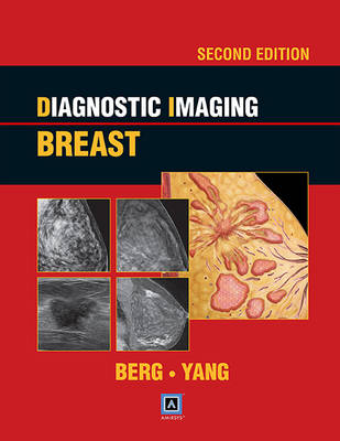 Diagnostic Imaging: Breast