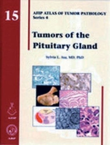 Tumors of the Pituitary Gland