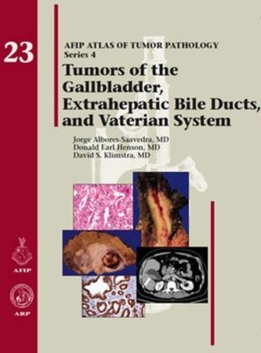 Tumors of the Gallbladder, Extrahepatic Bile Ducts, and Vaterian System