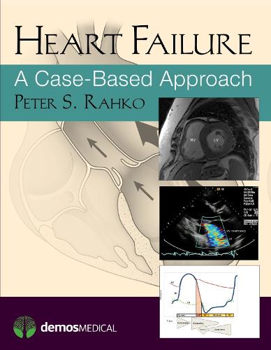 Heart Failure
