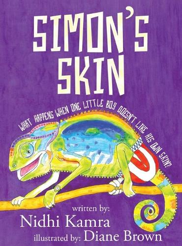 Simon's Skin