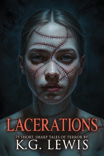 Lacerations