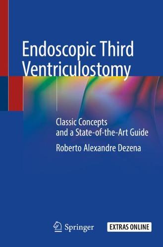 Endoscopic Third Ventriculostomy