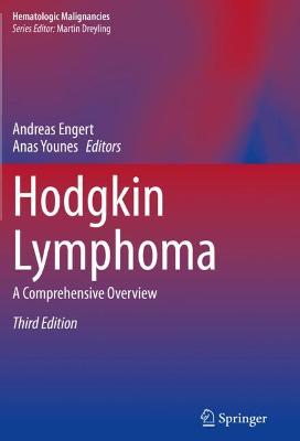 Hodgkin Lymphoma