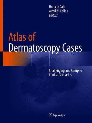 Atlas of Dermatoscopy Cases